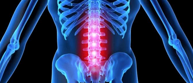 Intervertebral disk deformation