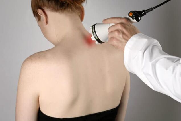 Laser therapy is used to combat back pain in the area of ​​the shoulder blades. 
