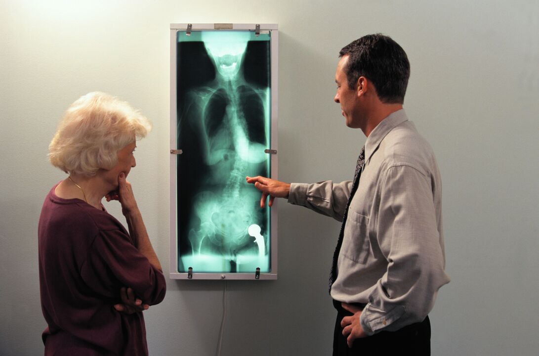 x-ray diagnosis of hip joint pain